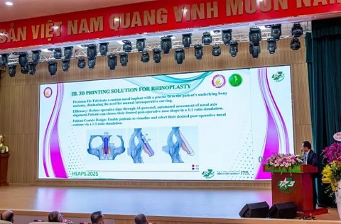 cong nghe nang mui fitme 3d xu huong moi trong phau thuat tham my