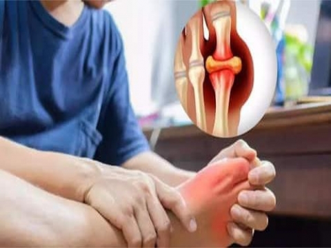 Tăng axit uric trong mùa đông, cách nào giúp giảm đau khớp?